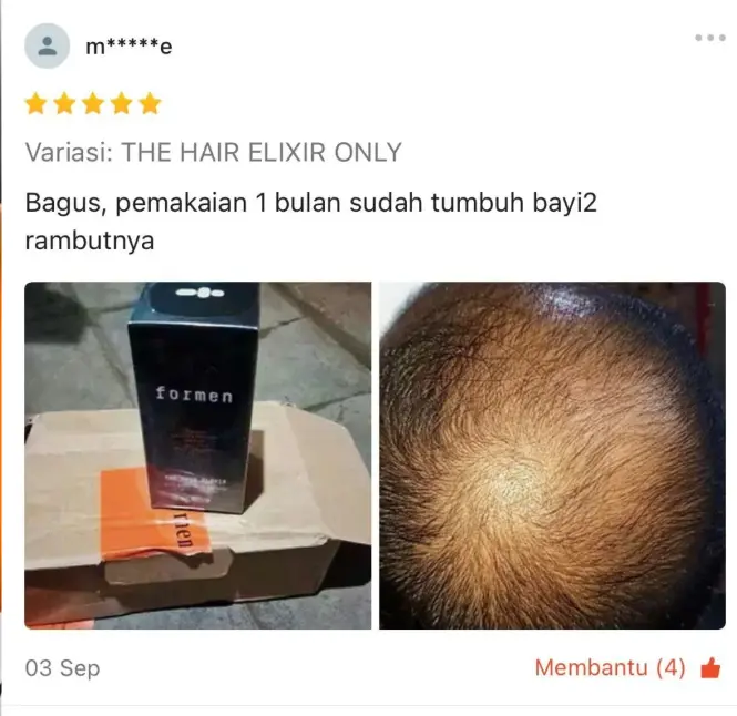 Ulasan pelanggan setelah satu bulan memakai The Hair Elixir